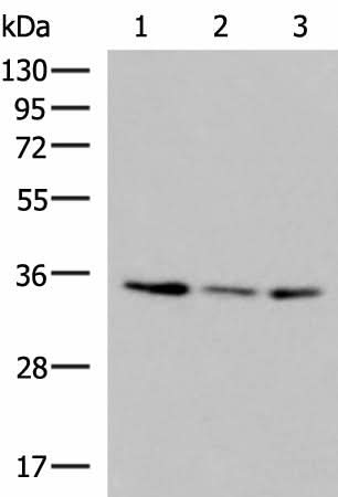Western blot analysis of HepG2 HL60 cell Human fetal liver tissue lysates using ISY1-RAB43 Polyclonal Antibody at dilution of 1:1000