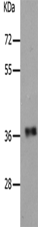 Anti-Human PARD6A Antibody - ABMIUM
