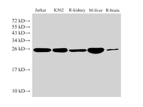 Anti-Human/Mouse/Rat GSTp1 Antibody - ABMIUM
