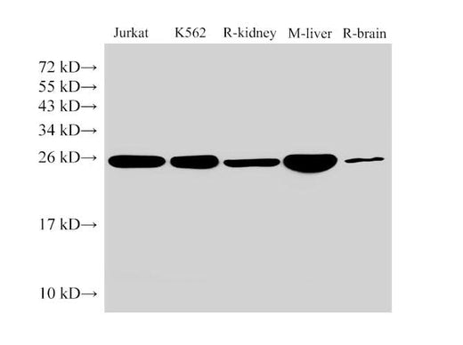 Anti-Human/Mouse/Rat GSTp1 Antibody - ABMIUM