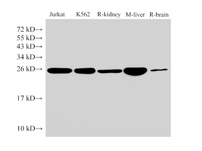 Anti-Human/Mouse/Rat GSTp1 Antibody - ABMIUM