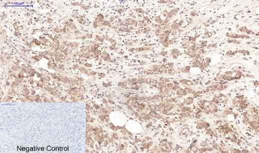 Anti-Human Lactoferrin Antibody [1A6]