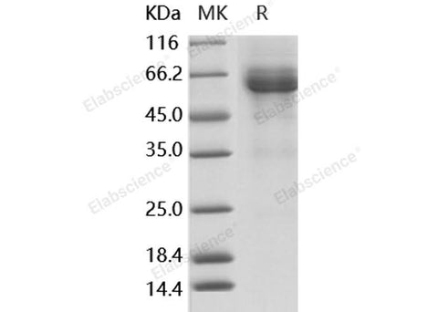 Recombinant Human LILRB4/CD85k/ILT3 Protein (aa 1-257, Fc Tag) - ABMIUM