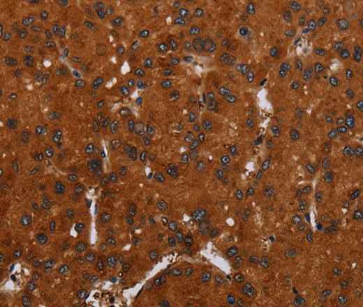 Anti-Human/Mouse NOX3 Antibody
