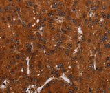 Anti-Human/Mouse NOX3 Antibody - ABMIUM