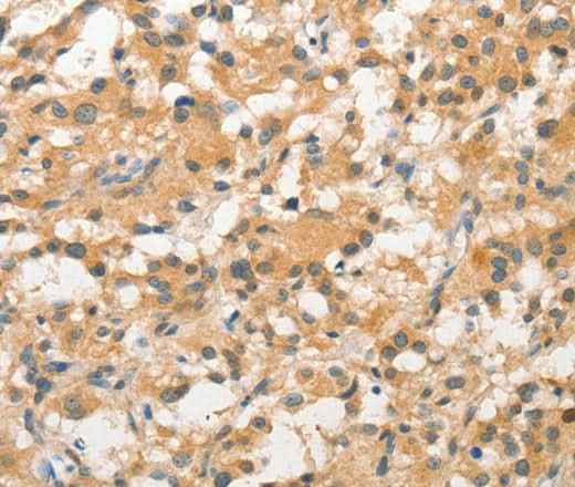 Anti-Human/Mouse STAM Antibody