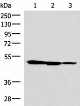 Western blot analysis of HepG2 K562 and A172 cell lysates using TTC38 Polyclonal Antibody at dilution of 1:1000