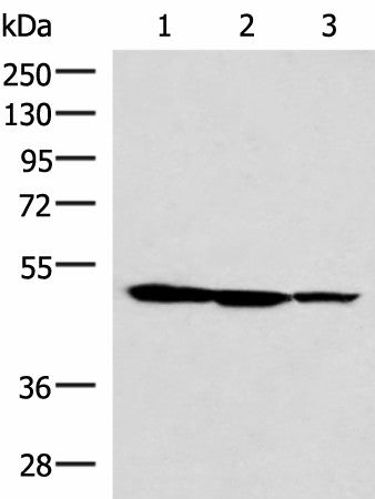 Western blot analysis of HepG2 K562 and A172 cell lysates using TTC38 Polyclonal Antibody at dilution of 1:1000