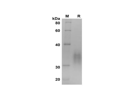 SDS-PAGE analysis of Human TNFR1/TNFRSF1A proteins, 2 μg/lane of Recombinant Human TNFR1/TNFRSF1A proteins was resolved with SDS-PAGE under reducing conditions, showing bands at 30-35 kDa.
