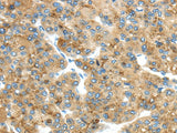 Anti-Human/Mouse TMED4 Antibody - ABMIUM