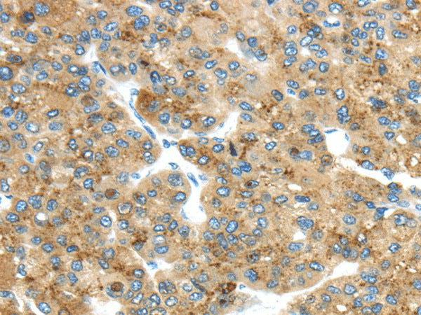 Anti-Human/Mouse TMED4 Antibody - ABMIUM