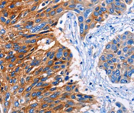 Anti-Human CLEC2B Antibody