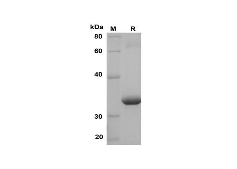 SDS-PAGE analysis of Human IL-33 proteins, 2 μg/lane of Recombinant Human IL-33 proteins was resolved with SDS-PAGE under reducing conditions, showing bands at 35 kDa.