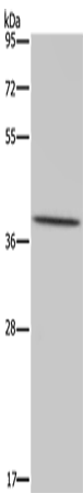 Anti-Human/Mouse/Rat MT-ND1 Antibody - ABMIUM
