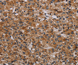 Anti-Human/Mouse p70 S6 kinase beta Antibody - ABMIUM