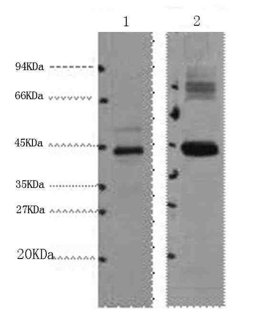 Anti-Human/Mouse/Rat AMACR Antibody [1F1]