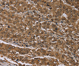 Anti-Human/Mouse MEIS1 Antibody - ABMIUM