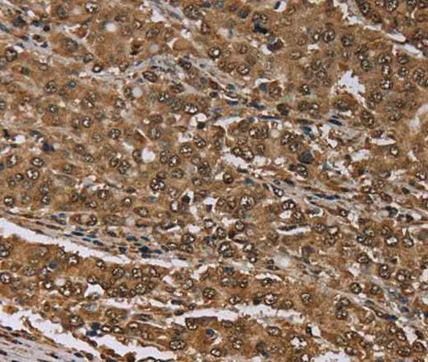 Anti-Human/Mouse MEIS1 Antibody