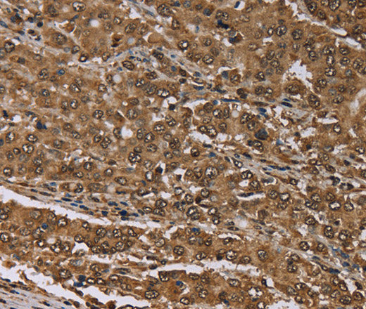 Anti-Human/Mouse MEIS1 Antibody - ABMIUM