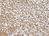 Immunohistochemistry of paraffin-embedded Human tonsil tissue using ZNF354A Polyclonal Antibody at dilution of 1:40(×200)