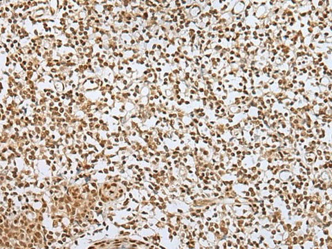 Immunohistochemistry of paraffin-embedded Human tonsil tissue using ZNF354A Polyclonal Antibody at dilution of 1:40(×200)