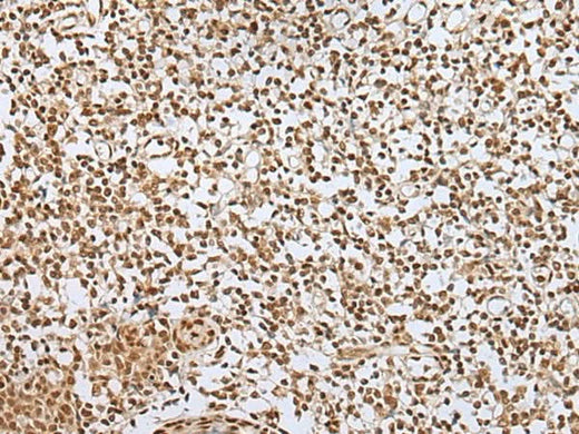 Immunohistochemistry of paraffin-embedded Human tonsil tissue using ZNF354A Polyclonal Antibody at dilution of 1:40(×200)