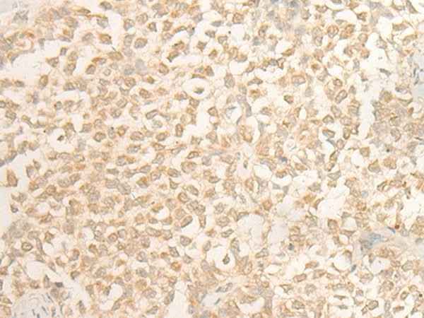 Anti-Human/Mouse DUSP27 Antibody