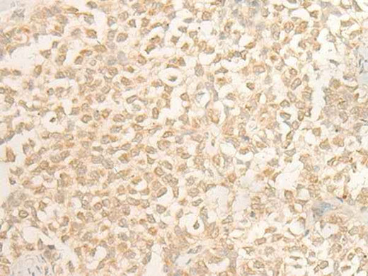 Anti-Human/Mouse DUSP27 Antibody