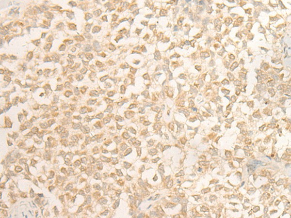 Anti-Human/Mouse DUSP27 Antibody - ABMIUM