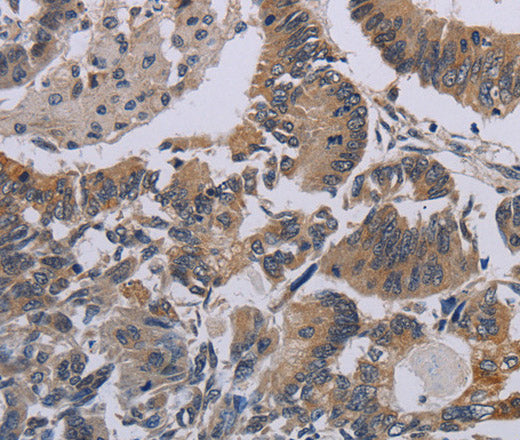 Anti-Human CCL1 Antibody - ABMIUM
