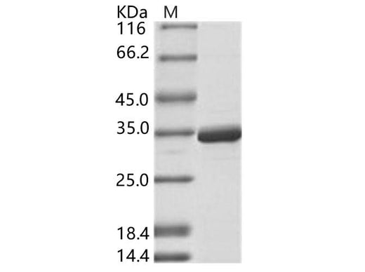 > 95 % as determined by reducing SDS-PAGE.