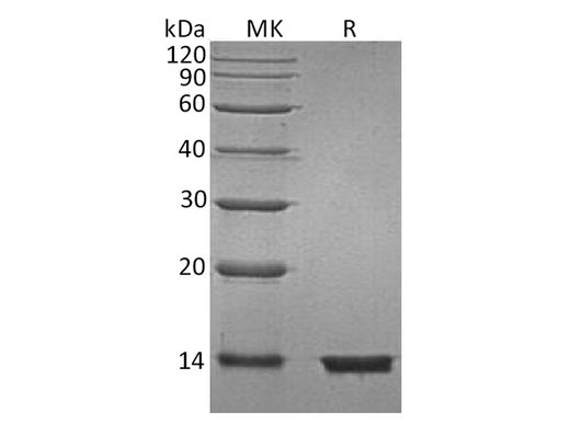 Recombinant Human Beta-2-Microglobulin/B2M Protein (His Tag) - ABMIUM