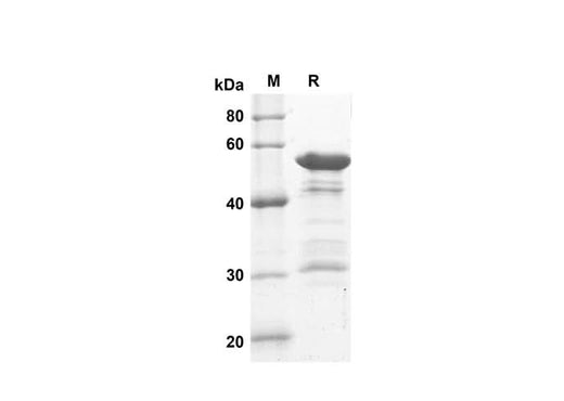 SDS-PAGE analysis of Human STAT3 APRF proteins, 2 μg/lane of Recombinant Human STAT3 APRF proteins was resolved with SDS-PAGE under reducing conditions, showing bands at 50 kDa.