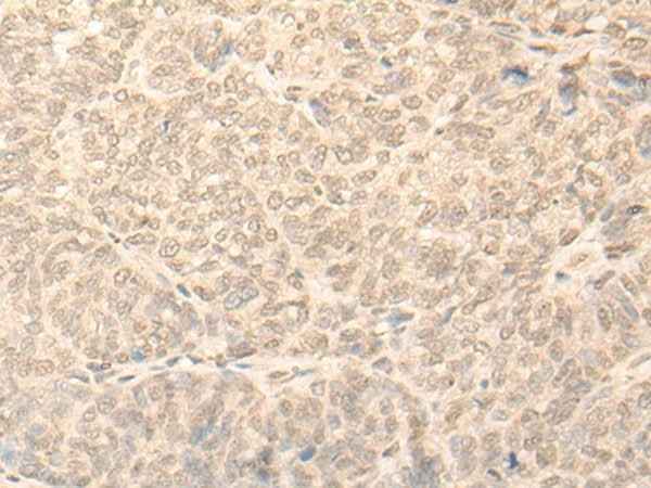 Anti-Human/Mouse/Rat NARF Antibody