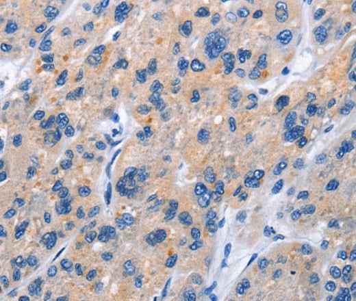 Anti-Human TNFRSF9 Antibody
