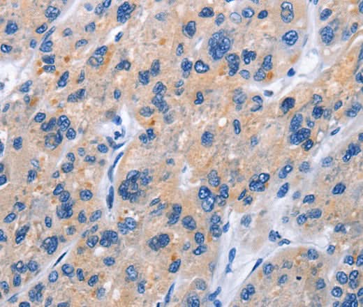 Anti-Human TNFRSF9 Antibody - ABMIUM