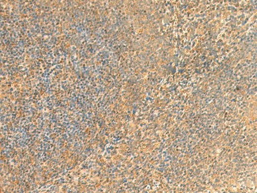 Immunohistochemistry of paraffin-embedded Human tonsil tissue using UBD Polyclonal Antibody at dilution of 1:50(×200)
