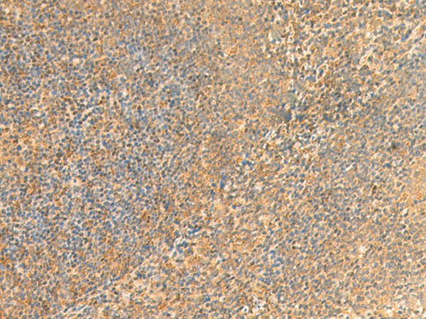 Immunohistochemistry of paraffin-embedded Human tonsil tissue using UBD Polyclonal Antibody at dilution of 1:50(×200)