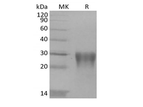 Recombinant Human Transforming Growth Factor Beta-1/TGFB1 - ABMIUM
