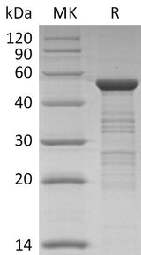 Recombinant HCoV-NL63 Nucleocapsid Protein - ABMIUM