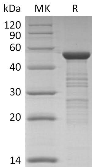 Recombinant HCoV-NL63 Nucleocapsid Protein - ABMIUM