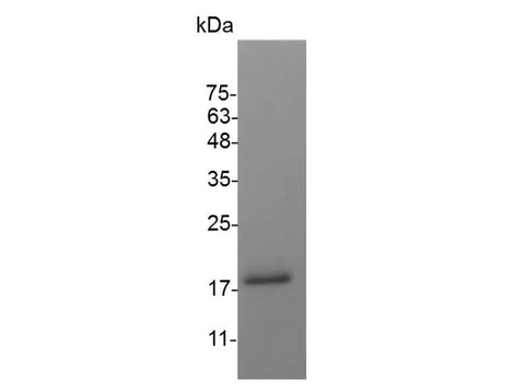 Recombinant Mouse CD27L protein(His Tag) - ABMIUM