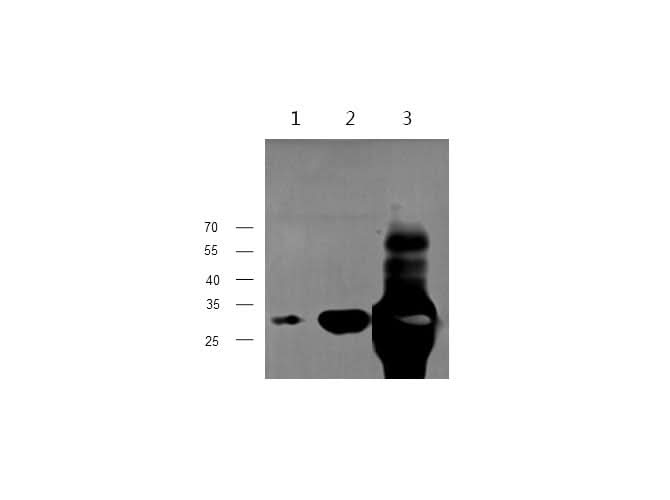 Anti-Mouse/Rat TNNI3 Antibody - ABMIUM