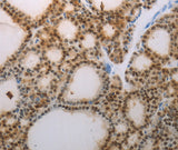 Anti-Human/Mouse/Rat S100A1 Antibody - ABMIUM