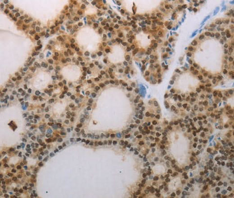 Anti-Human/Mouse/Rat S100A1 Antibody - ABMIUM
