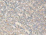 Immunohistochemistry of paraffin-embedded Human tonsil tissue using MOB1A Polyclonal Antibody at dilution of 1:50(×200)