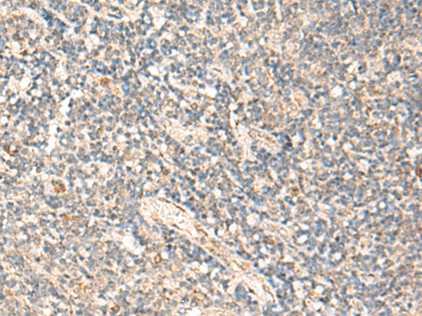 Immunohistochemistry of paraffin-embedded Human tonsil tissue using MOB1A Polyclonal Antibody at dilution of 1:50(×200)