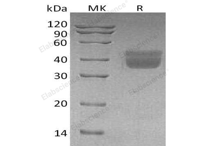 Recombinant Human Kallikrein 1/KLK1 Protein (His Tag) - ABMIUM