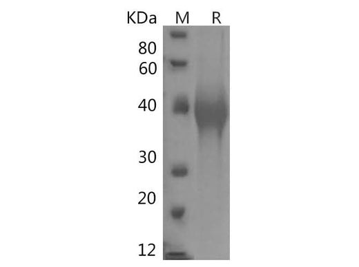 SDS-PAGE analysis of Human TIM-3/HAVCR2 proteins, 2 μg/lane of Recombinant Human TIM-3/HAVCR2 proteins was resolved with SDS-PAGE under reducing conditions, showing bands at 38 kDa.