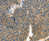 Anti-Human/Mouse COL4A2 Antibody - ABMIUM